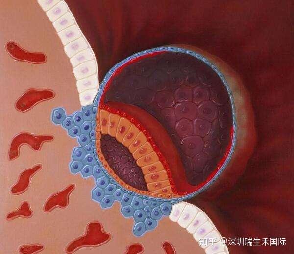 试管婴儿移植鲜胚和囊胚哪个成功率更高? - 知乎