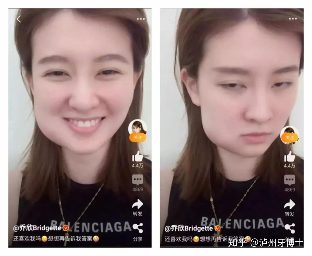 乔欣拔完智齿后上热搜网友这是开了特效吧哈哈哈