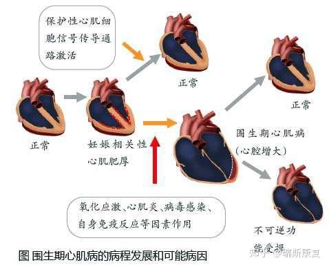 缺血性心肌病并发症有哪些呢