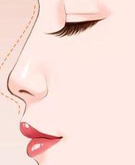 激光皮秒有副作用吗 v2-953f33940aa32b5c994c35af63eb3fa3_b.jpeg