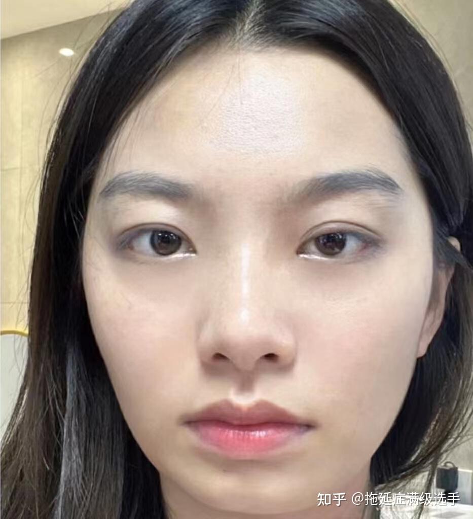 大家公认最好用的美白面霜我买了,2个月黄黑皮逆袭冷白皮,难怪北京