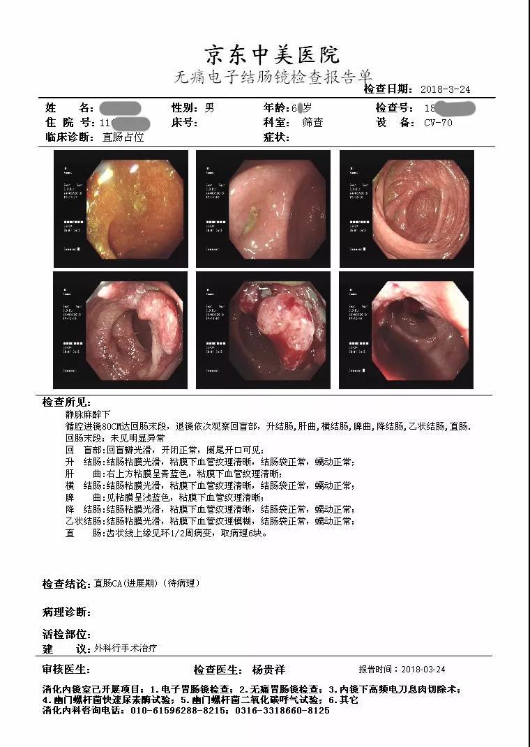 肠镜检查报告