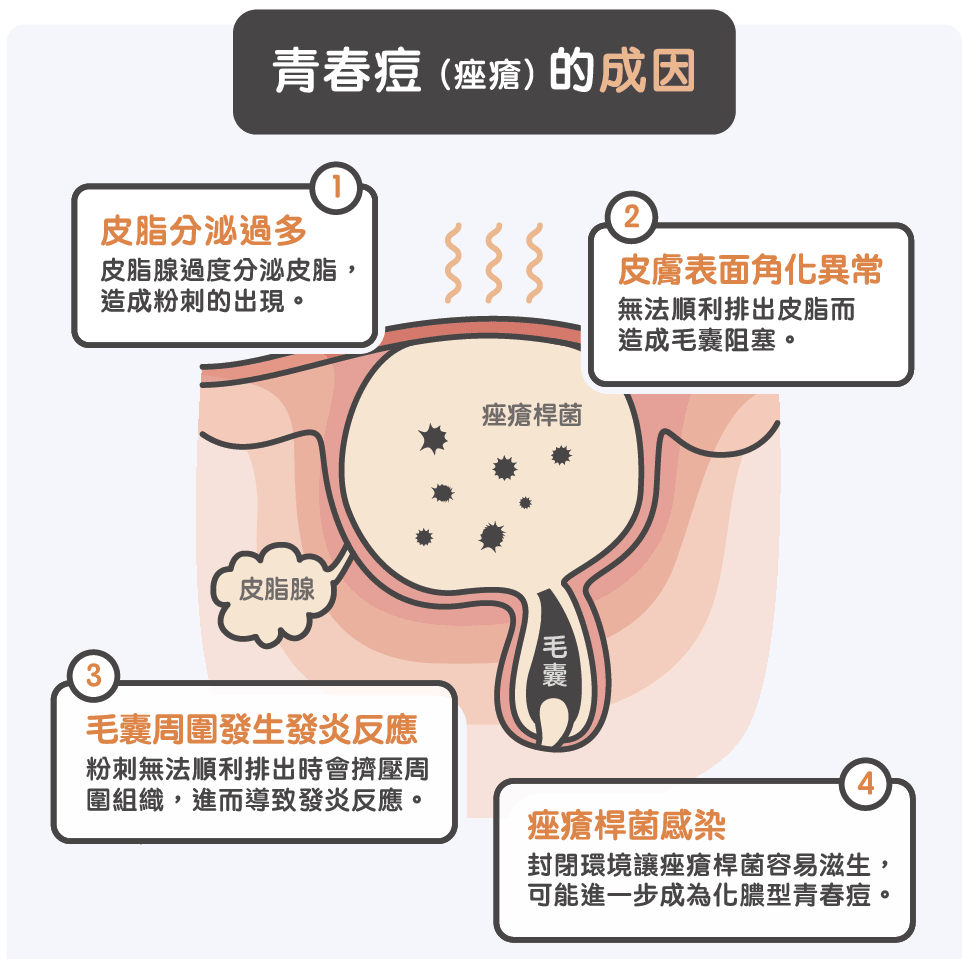 为什么会长青春痘图片