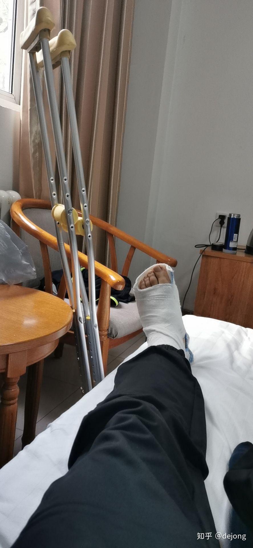 记录第五跖骨基底部骨折养伤记