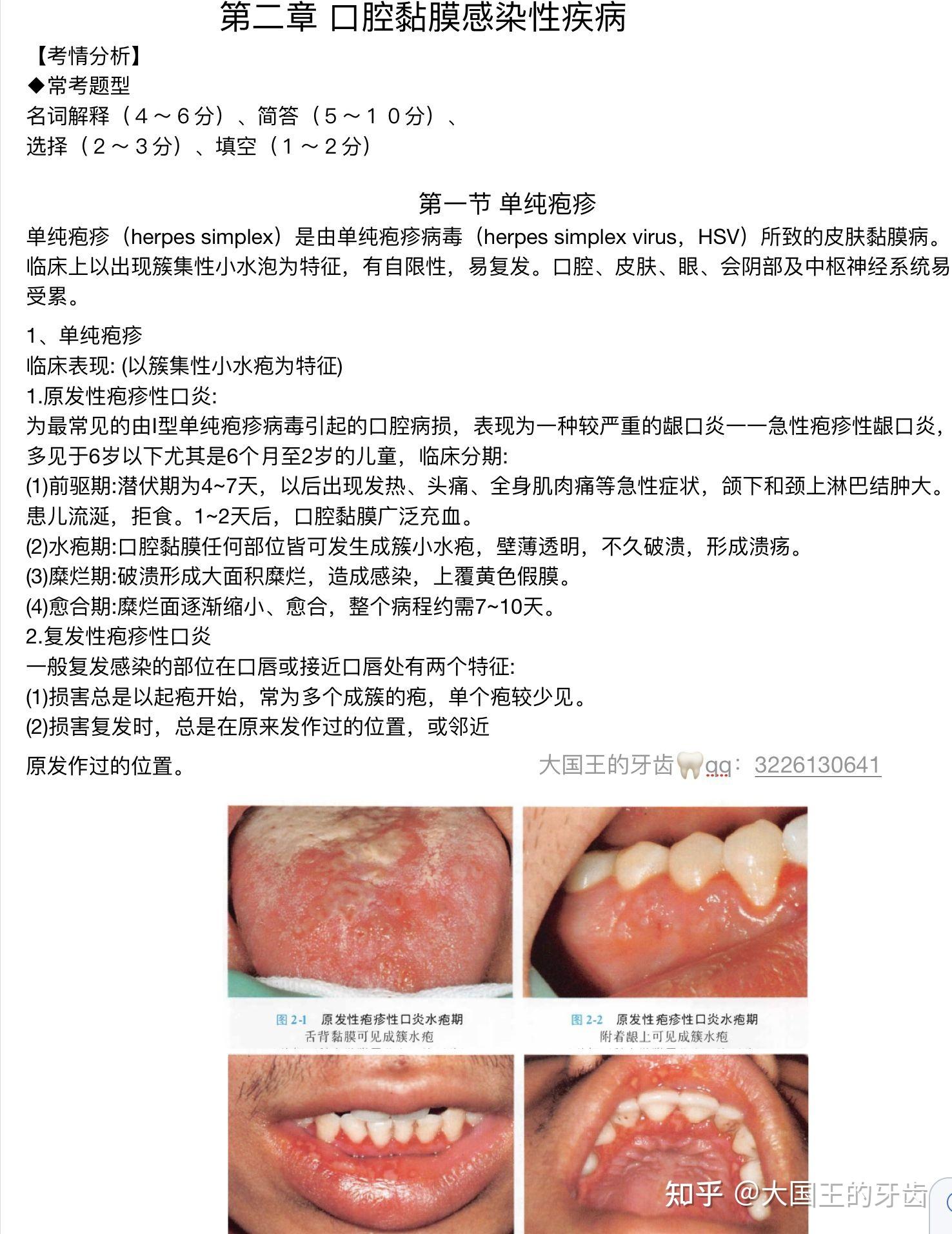 口腔粘膜病学 - 知乎
