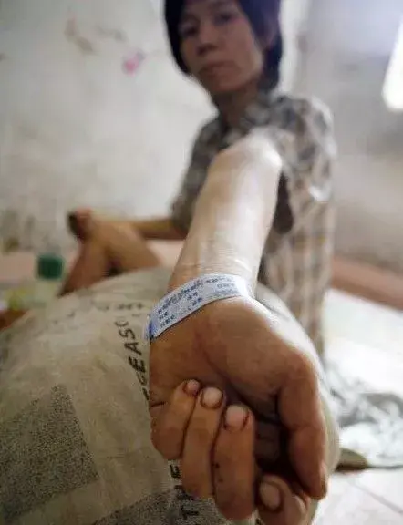 地狱在人间镜头下吸毒者吴桂林人生最后的19天