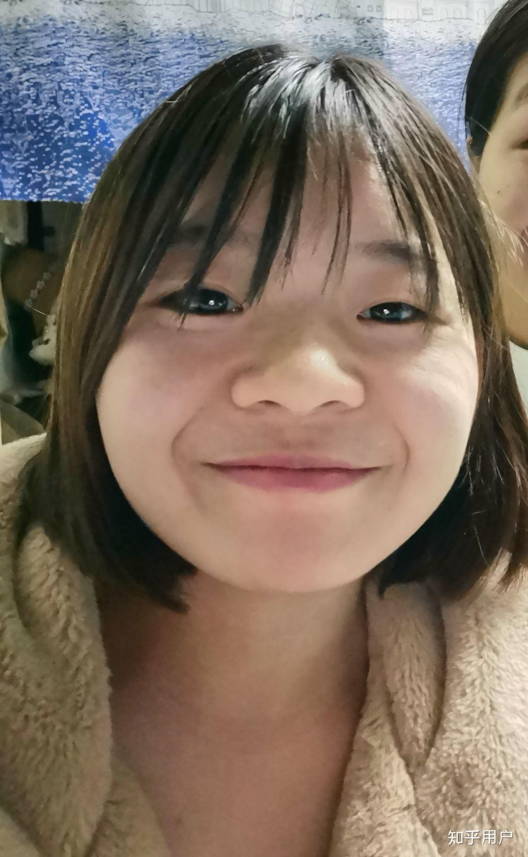 单眼皮肿眼泡塌鼻梁凸嘴巴大脸盘婴儿肥是什么样的