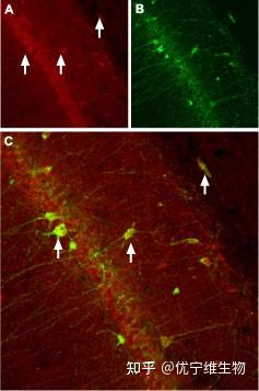 揭秘L型钙离子通道信号在转录调控过程中的作用 - 知乎
