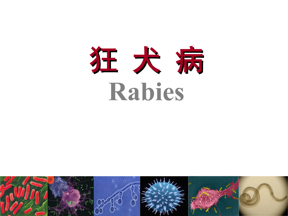 狂犬病の症状は何ですか?