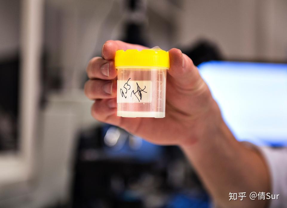 捐精是一种怎样的体验?