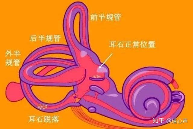 v2-970c0d34002f4e74f69739c401bbbe87_r.jpg