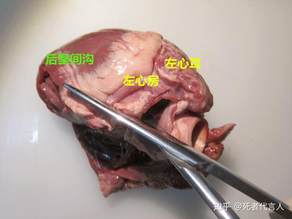 心脏的法医学解剖
