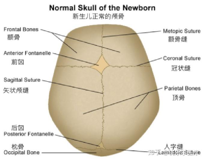 头颅畸形有哪些类型 - 知乎