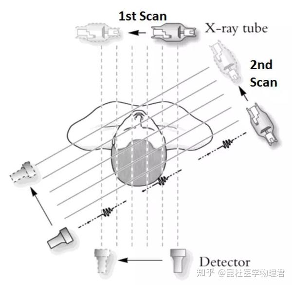 彼时限于技术水平,x射线管与探测器一一对应,平移覆盖整个平面后,才能
