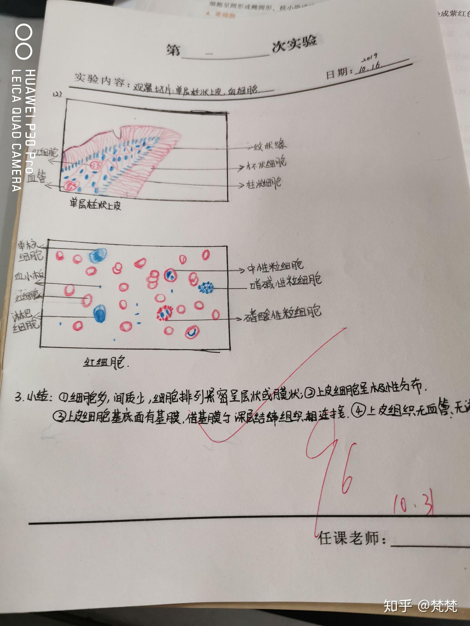 单层柱状上皮实验报告图片