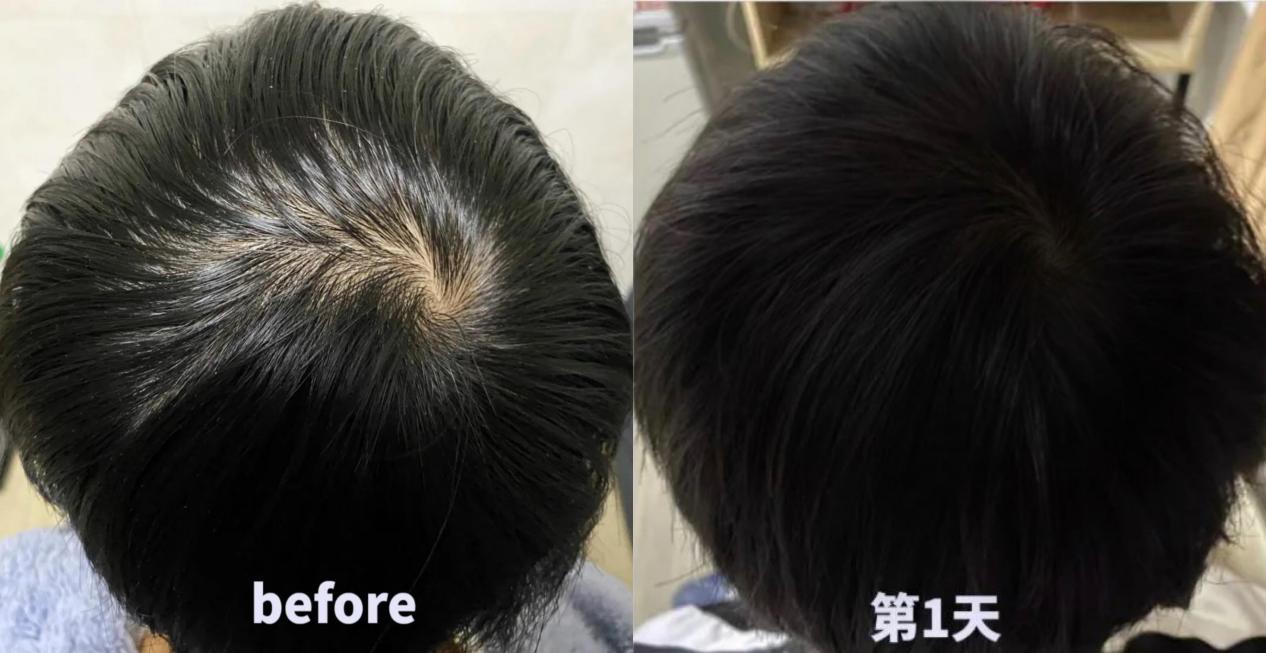 它用了defenscalp64清洁配方,这个是有专利的,再加上柳兰花叶提取物