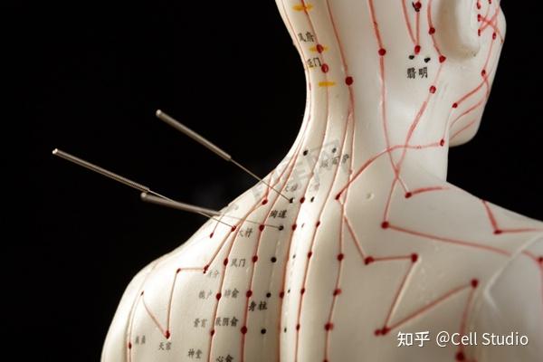 针灸 Acupuncture: origin, application and modern evaluation of an ancient ...