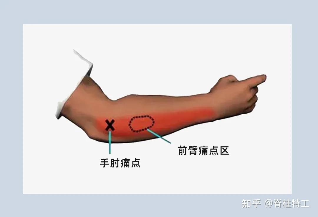 手肘是哪个位置图片