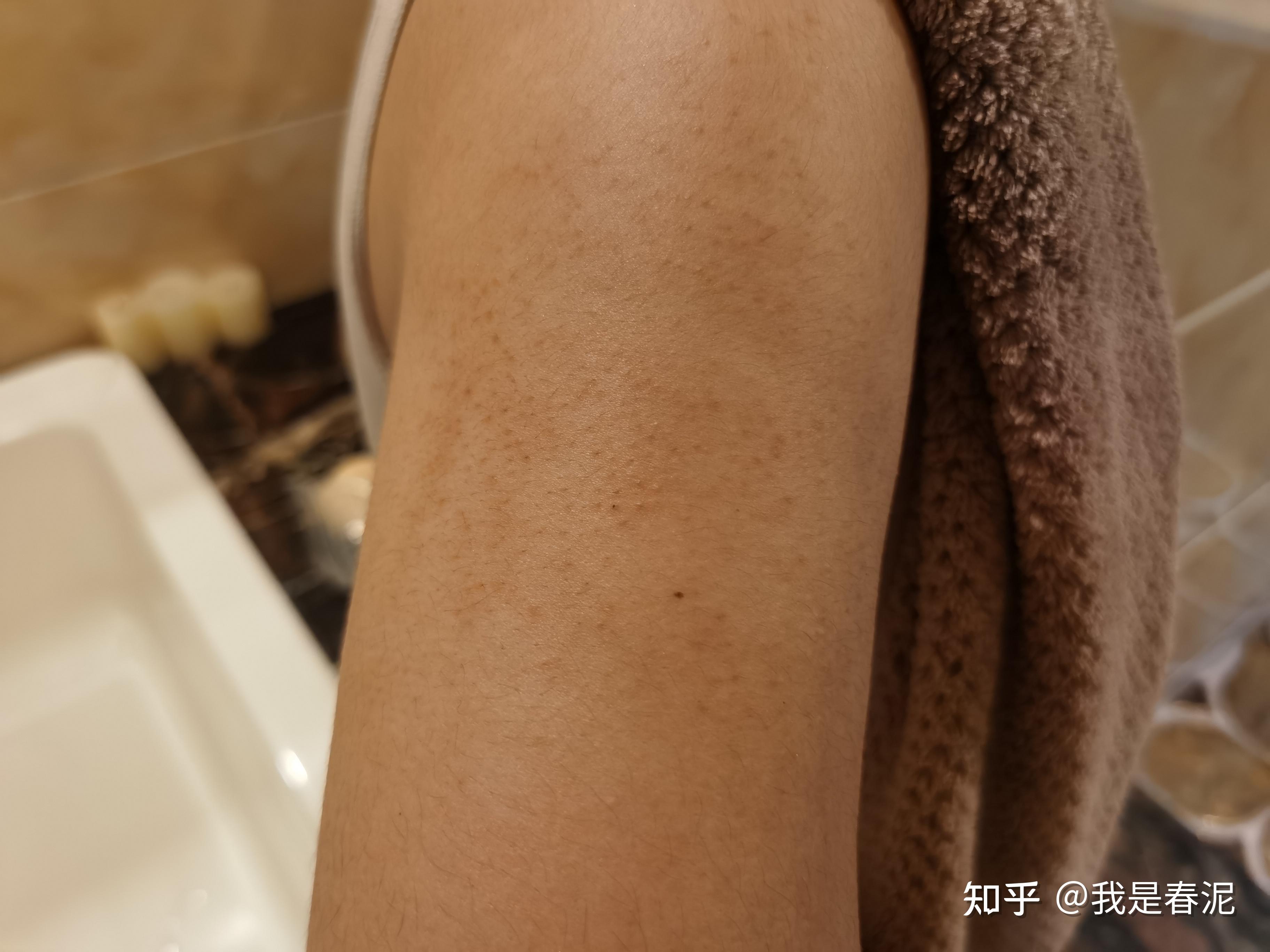 你们都是怎么去鸡皮的?