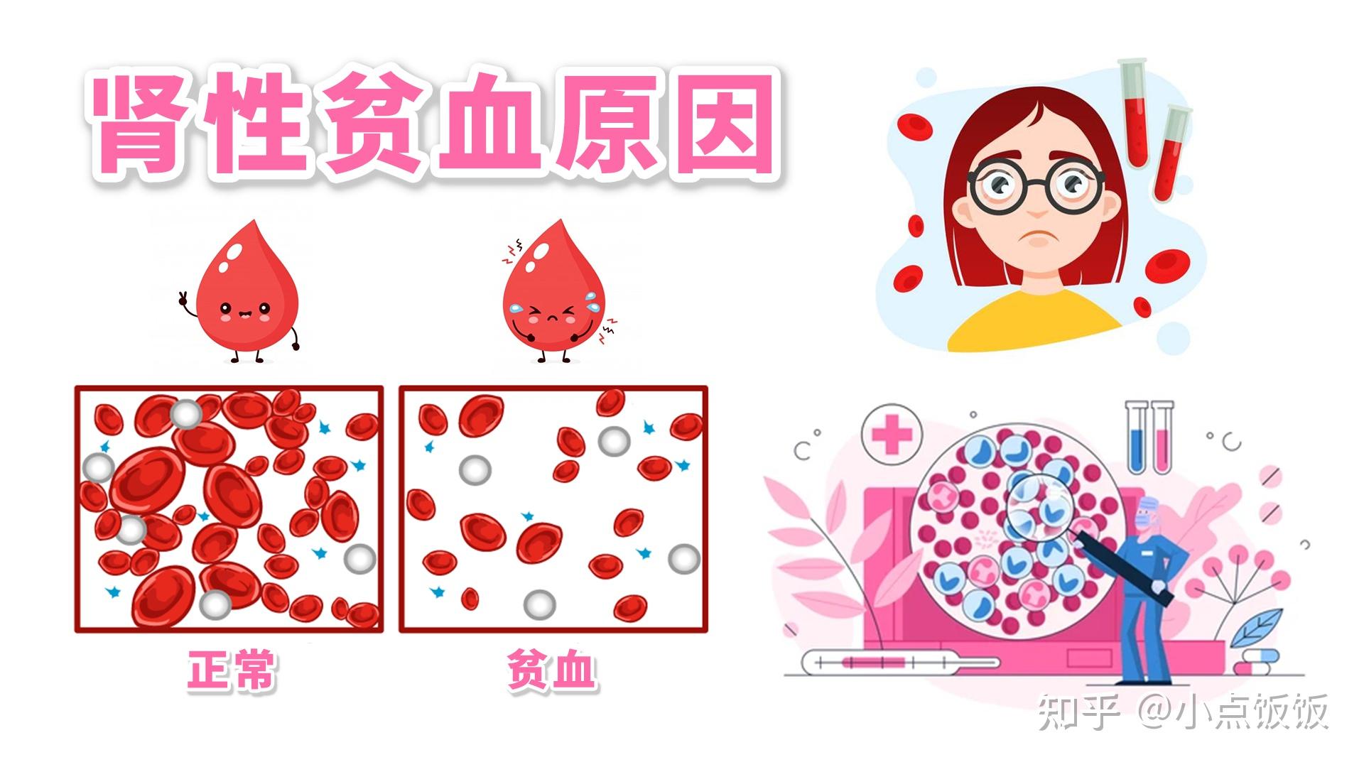 肾性贫血的原因都有哪些? | 医学科普 - 知乎