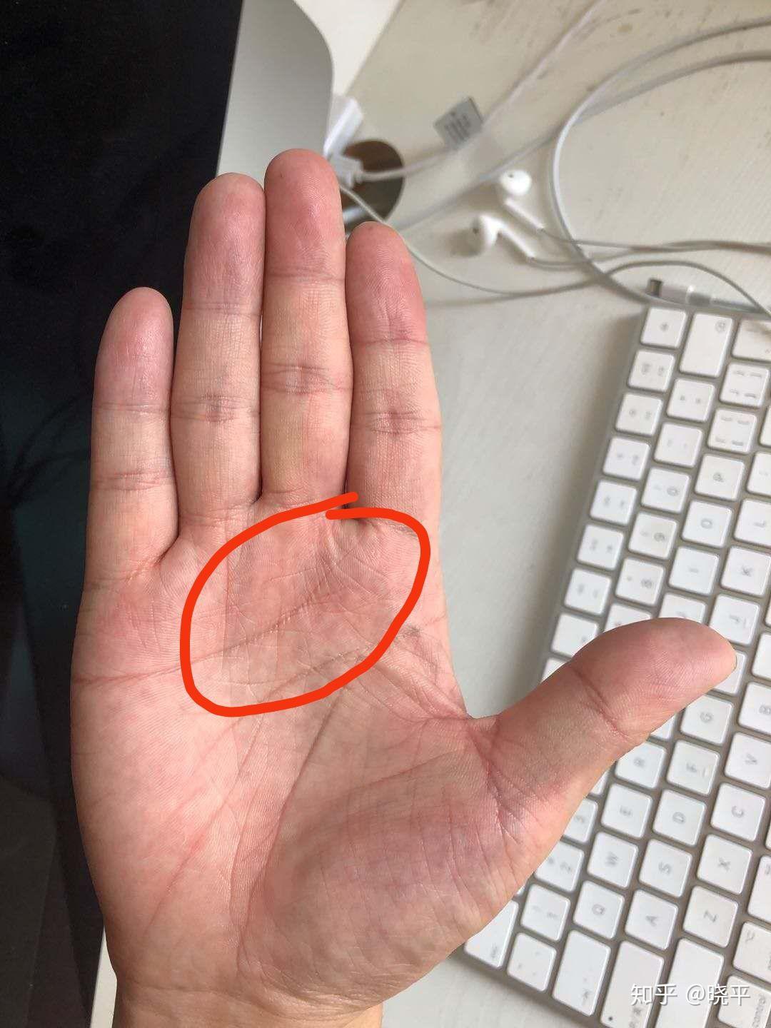 掌纹看健康之1线