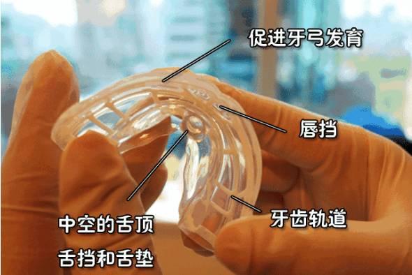 mrc儿童早期干预性牙齿矫正4岁即可开始治疗