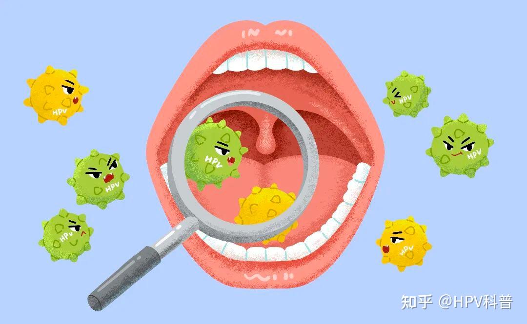 如舌头根部,喉咙后部,扁桃体等部位,与hpv不相关的癌症一般发生在舌头