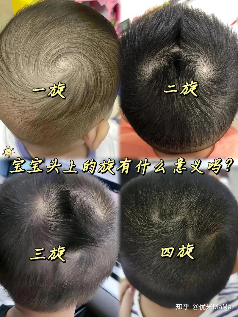 孩子头顶“几个旋”到底意味着什么?不少父母不懂,建议都看看 - 知乎