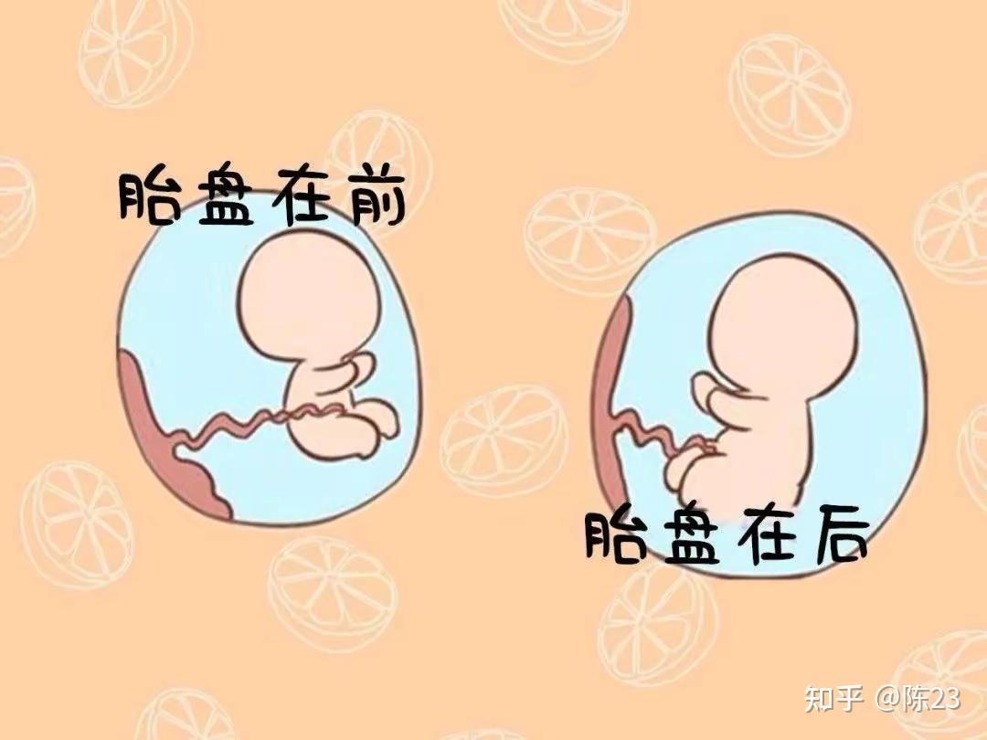 明明白白做超声（三）：早期妊娠胎儿结构超声检查 - 知乎