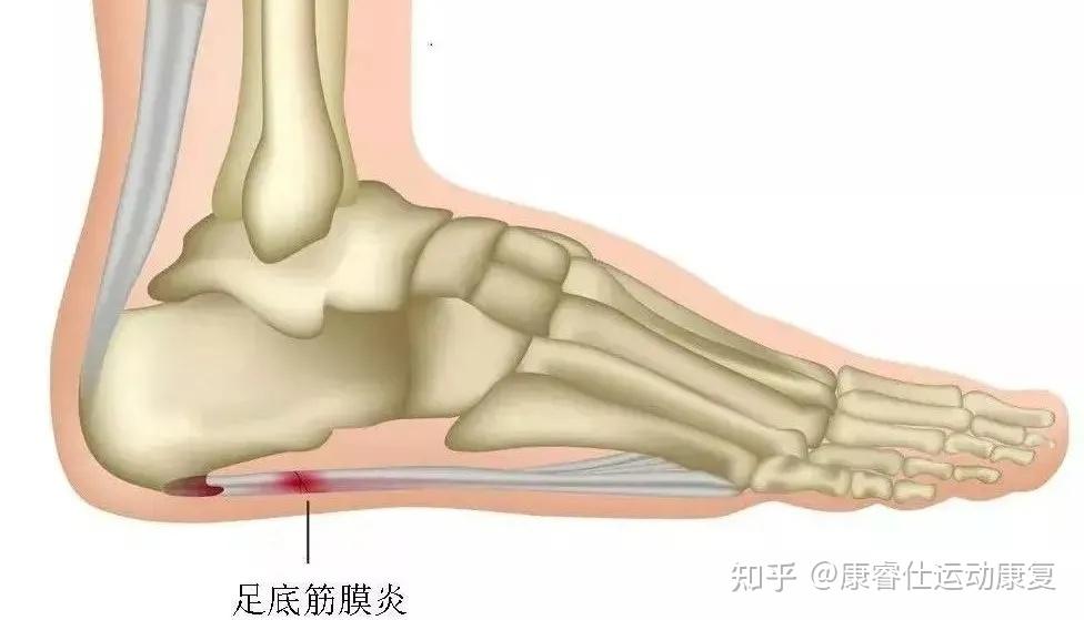 伤筋动骨的图片大全图片