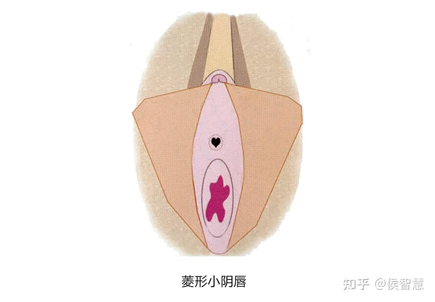 小阴唇 
