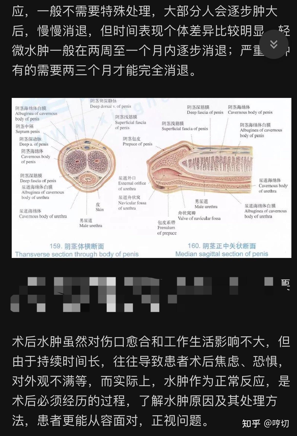 现在晨勃已经不痛了 现在就剩两个问题 一个是水肿不知道啥时候能消