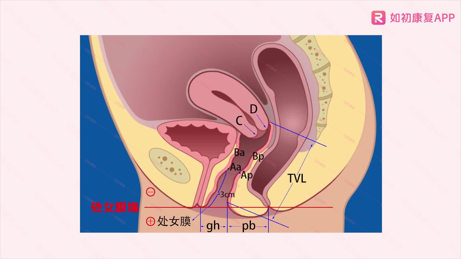 【如初】第①节:认识盆底肌