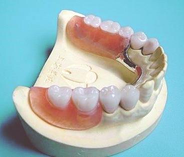 单独一颗假牙的图片图片