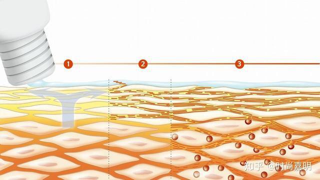 油皮毛孔拒粗大,三招练就陶瓷肌 - 知乎