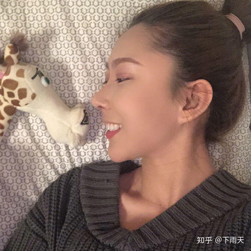 蒜头鼻的逆袭隆鼻后自信翻倍