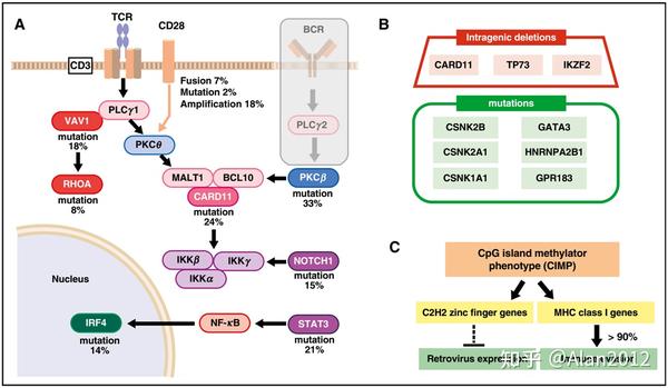 成人T细胞白血病（Adult Tcell leukemia，ATL） 知乎
