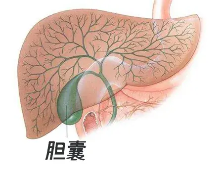 胆囊长息肉要不要切除?当断不断,小心癌变!