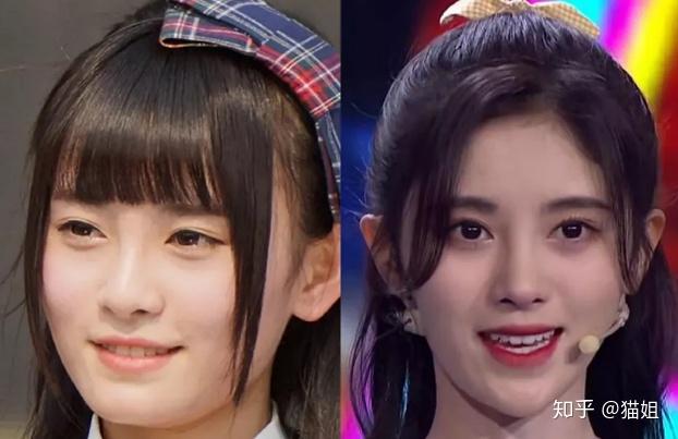 鞠婧祎整容变化这么大有没有后遗症