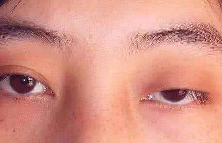 眼睛干涩飞蚊症老花眼白内障戴上它让眼睛恢复健康