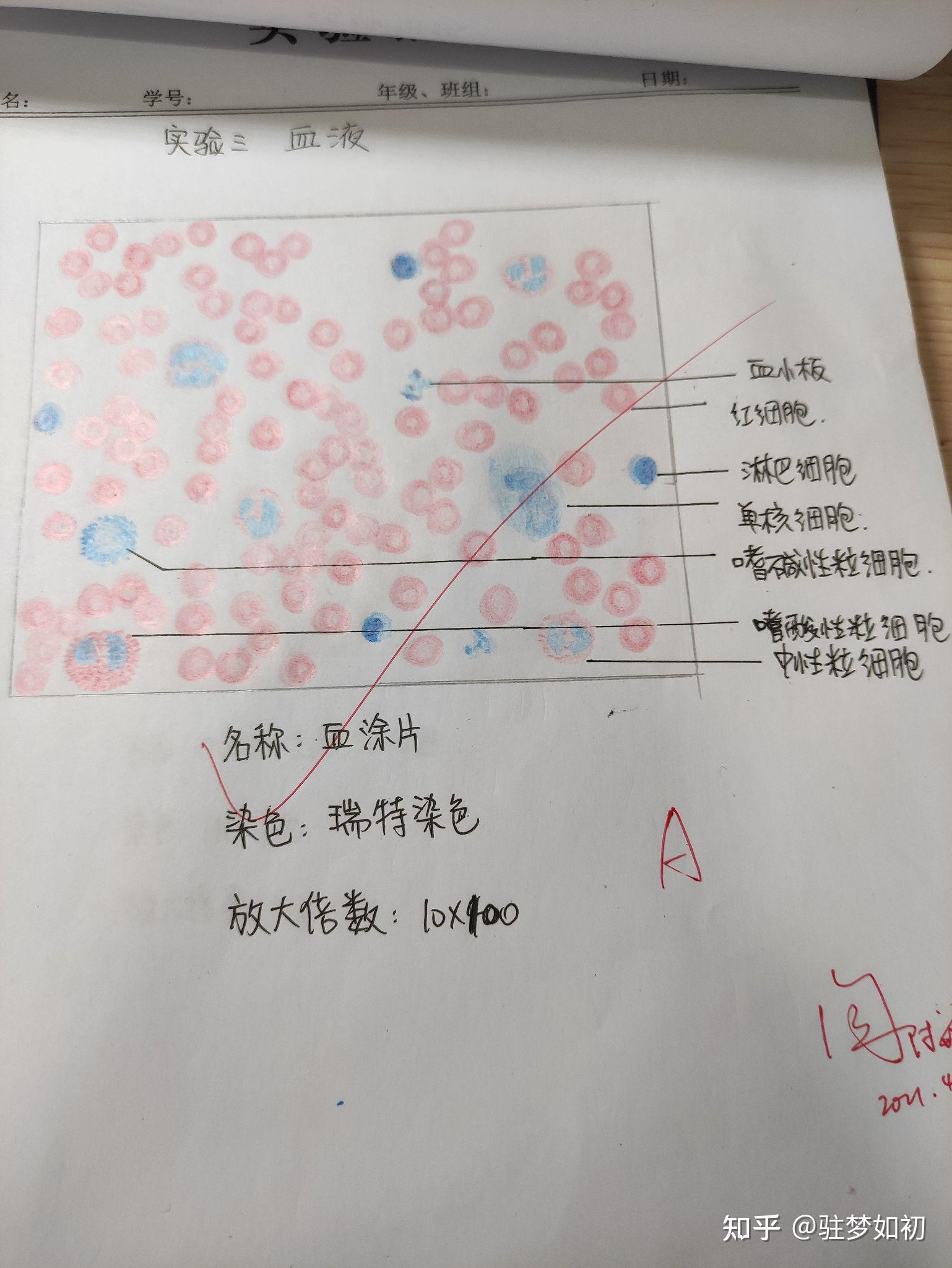 粒细胞红蓝铅笔手绘图图片
