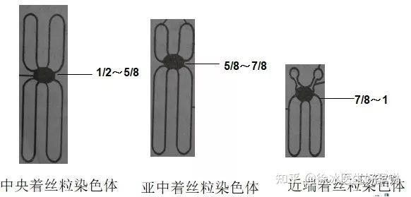 罗伯逊易位 - 知乎