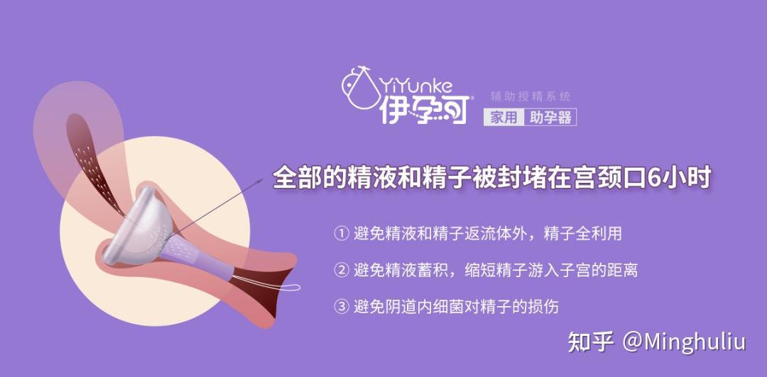 美国伊孕可家用助孕器 | 中华医学会第十五次全国生殖医学学术会议完美落幕 - 知乎
