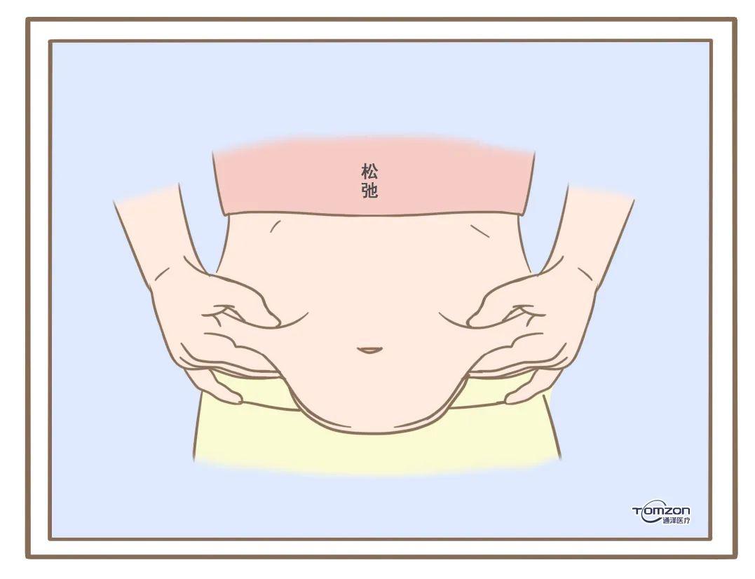 03腹壁疝04盆腹脏器下垂05悬垂腹雷区:束缚带不建议使用束缚带