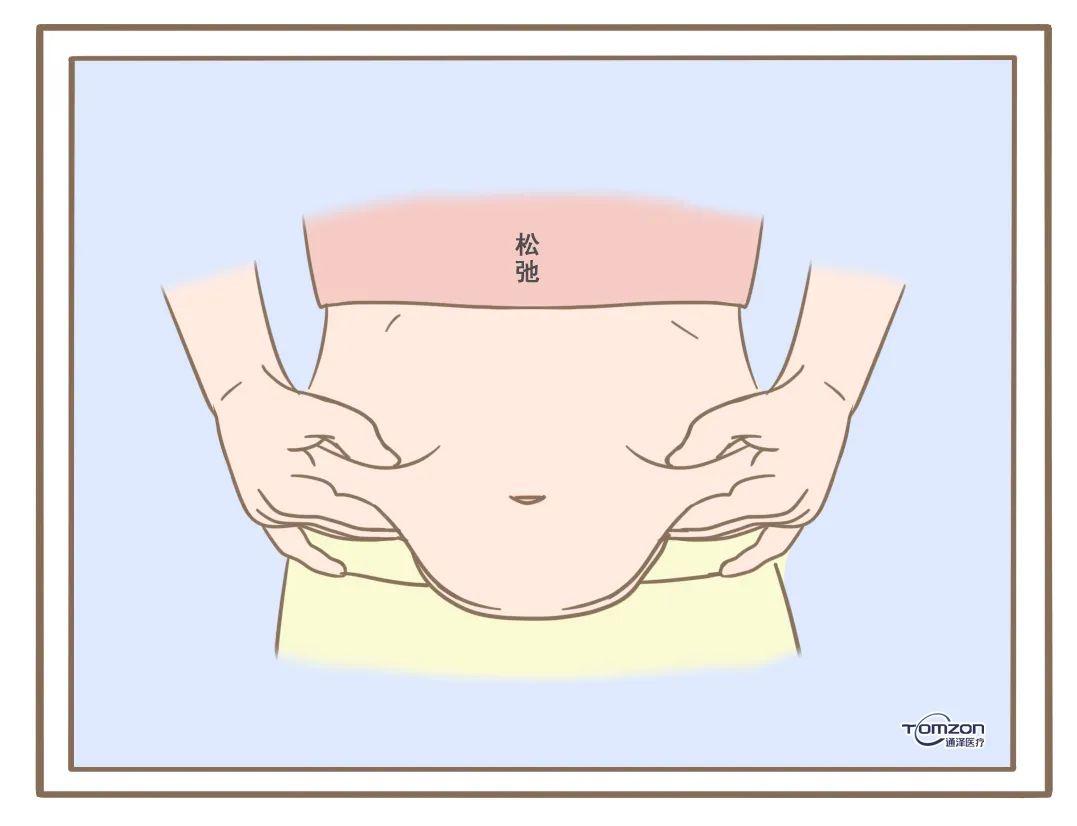 产后肚子下垂图片图片
