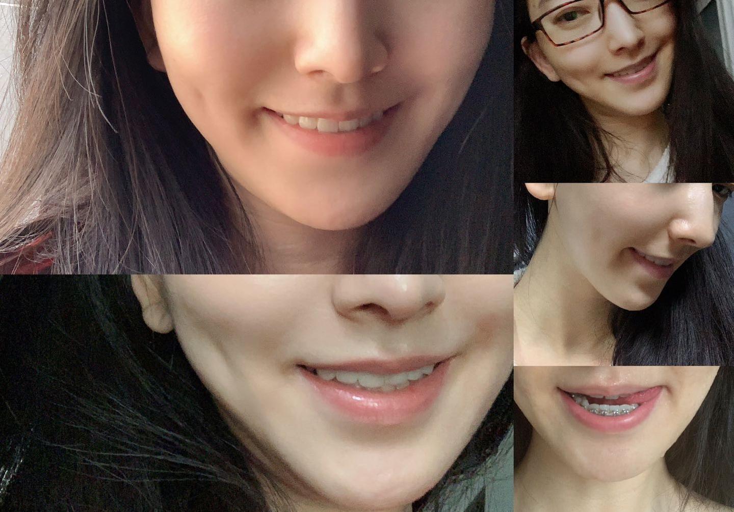 空军军医大学(第四军医大学)口腔医院正颌手术攻略(商洪涛案例) - 知