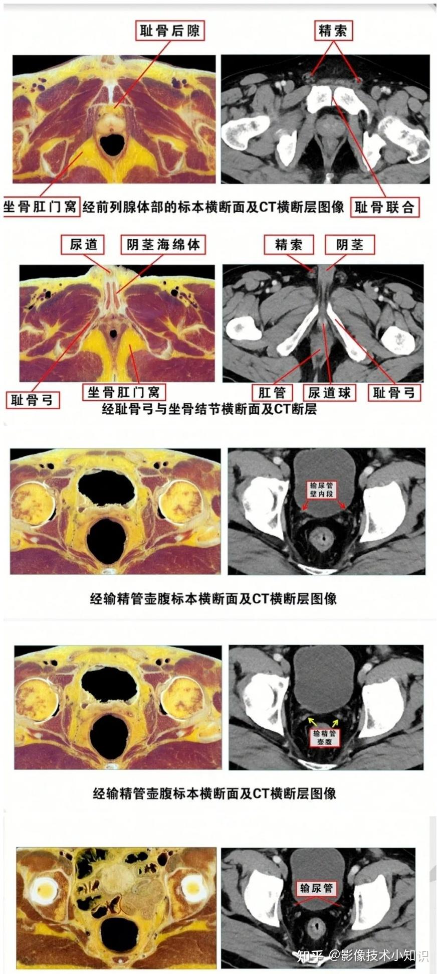 男性生殖系统解剖 知乎 