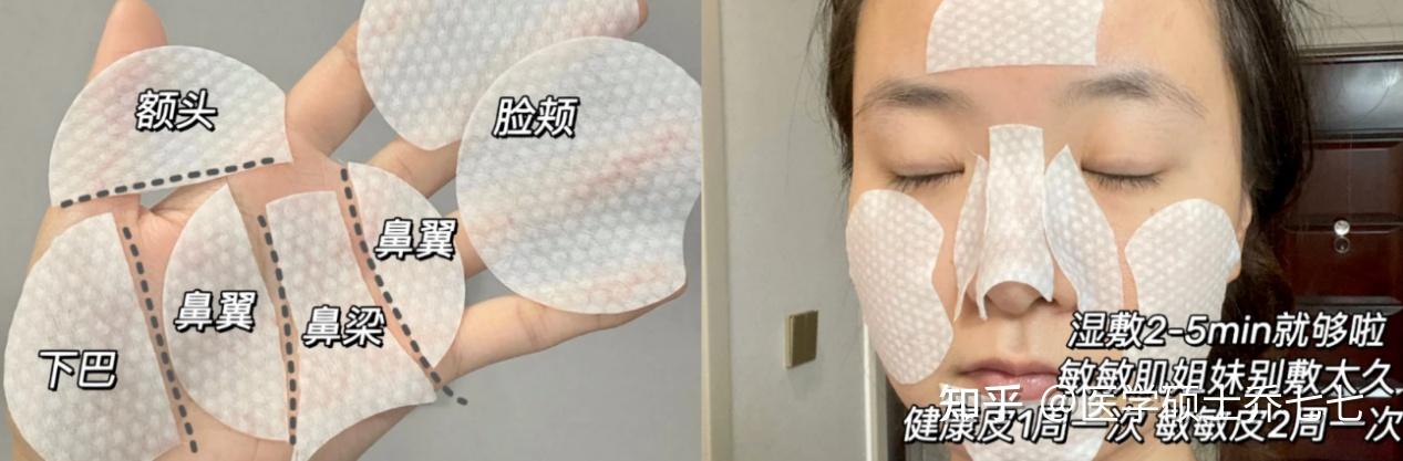新手刷酸必看:超全刷酸教程!这两个刷酸步骤大多数新手都会忽略!!医学硕士教你如何正确刷酸!!
