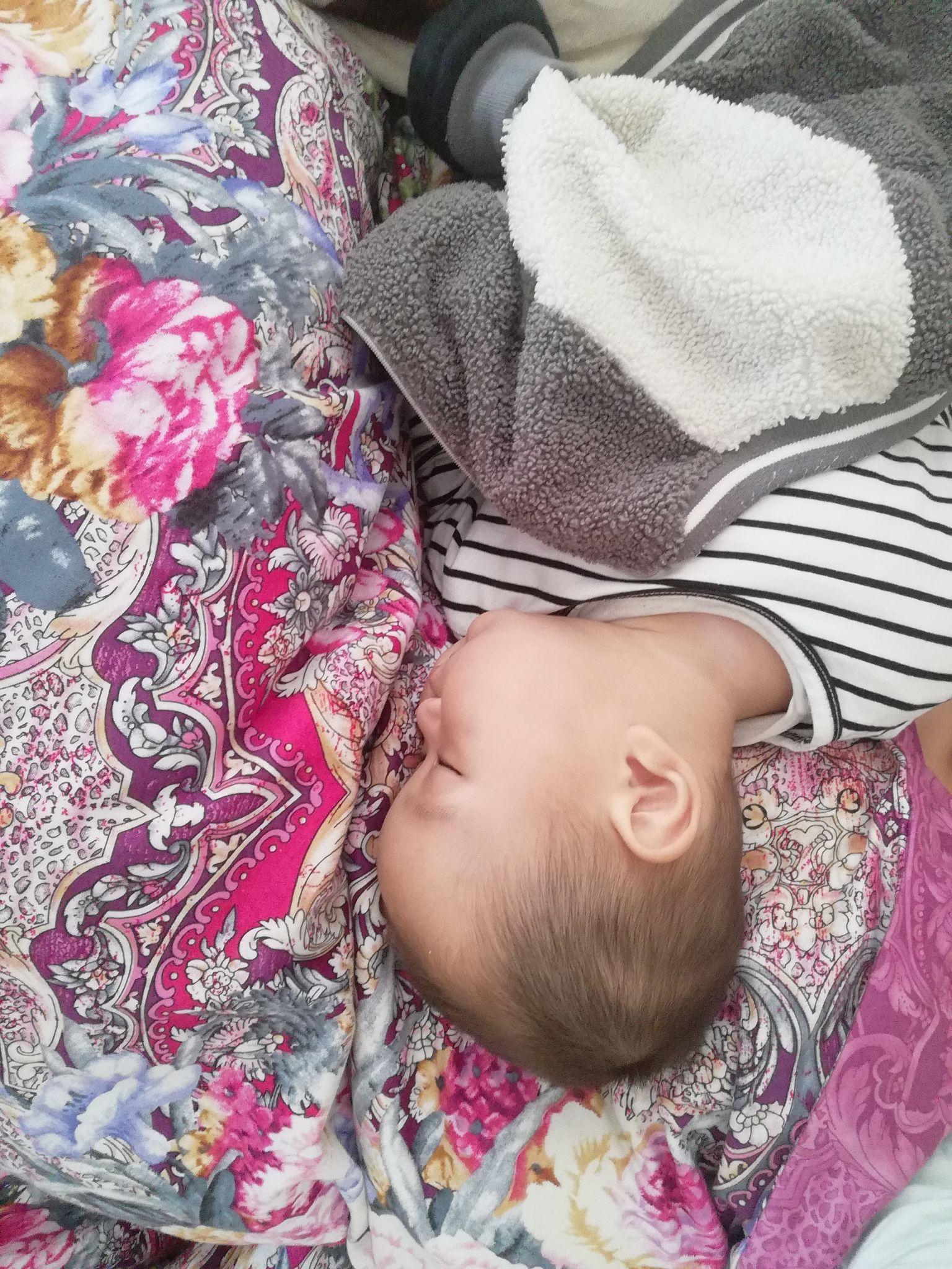 七个多月的婴儿头睡扁了还能矫正吗?