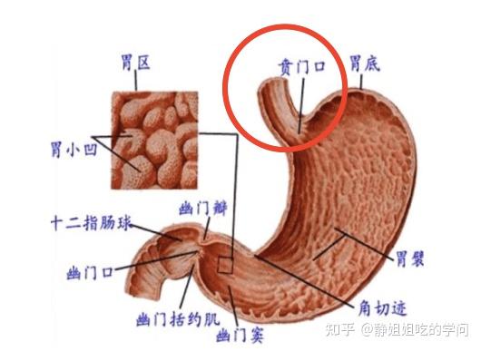 胃酸过多、反酸、烧心，应该怎么吃？ - 知乎